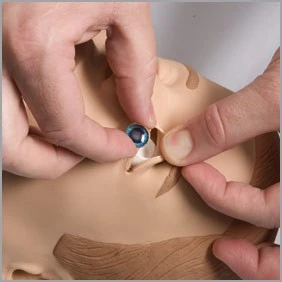 Installerar blått öga i medicinsk modell