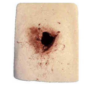 Simulerat sår för medicinsk utbildning