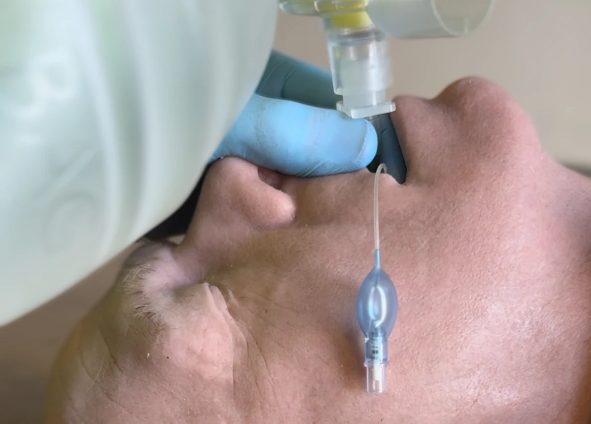 Sjukvårdspersonal intuberar patient med andningsmask.