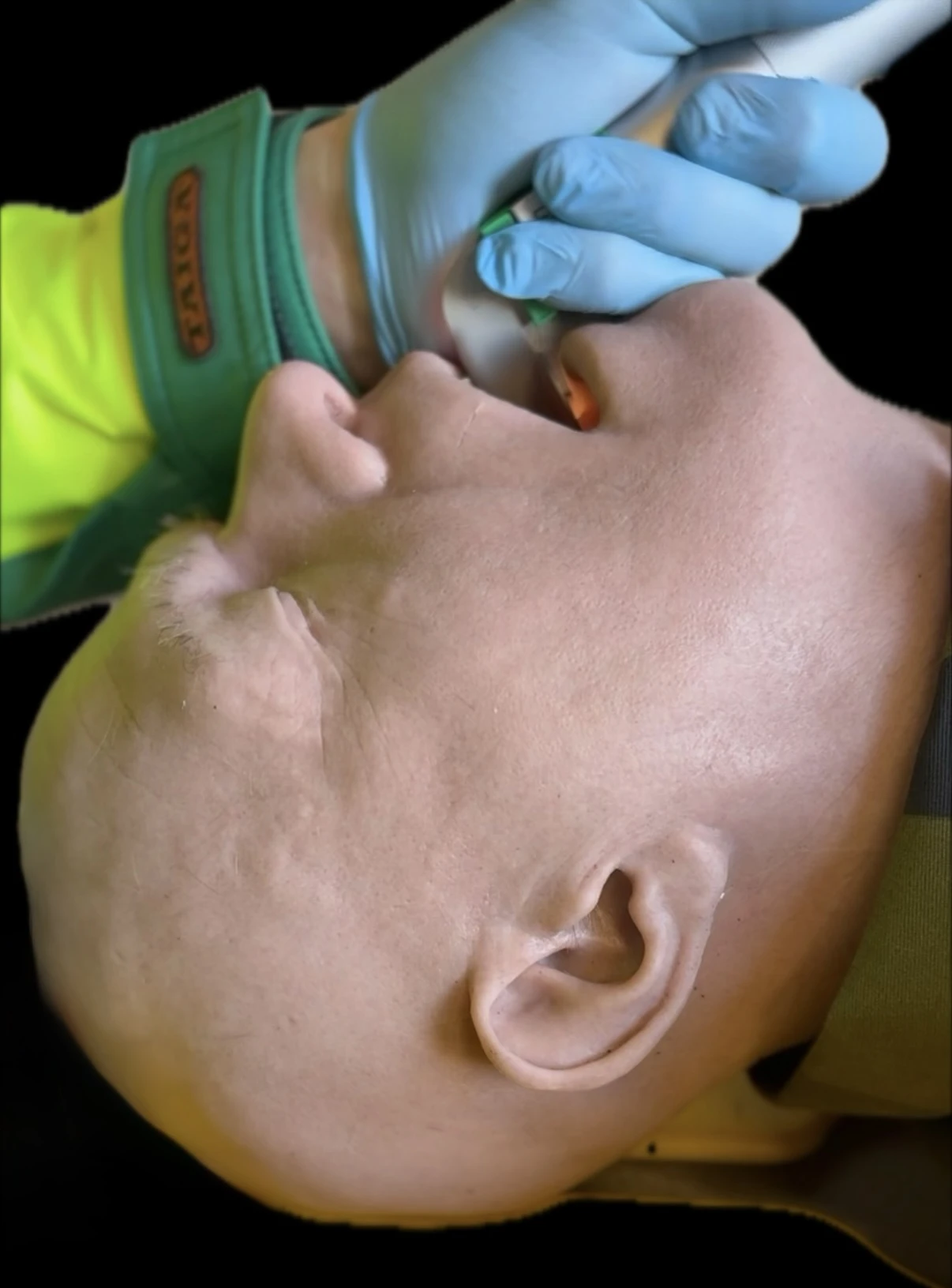 Intubation på en medicinsk träningsdocka